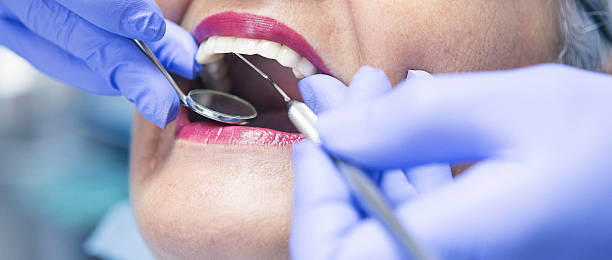 Best Emergency Wisdom Teeth Removal in Cairo, IL